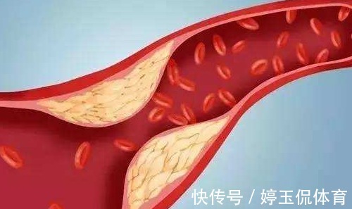 霜桑|建议中老年,若不缺钱多吃这2物,稳血脂通血管,还不贵