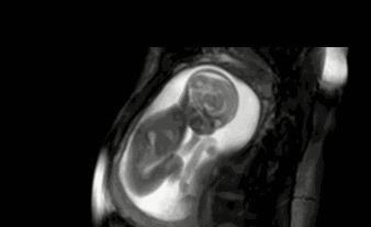 怀孕|孕妈怀孕时有这3个特征,生出的孩子多半很聪明,全占的偷着笑吧