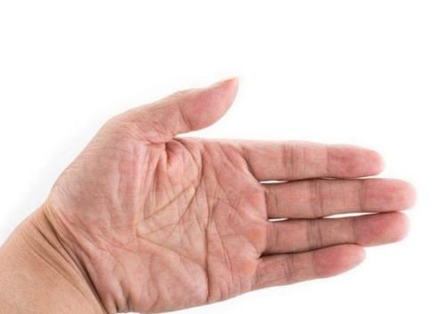  手上|肝癌不痛不痒么，手上的6个变化，或许是肝在向你“发出信号”