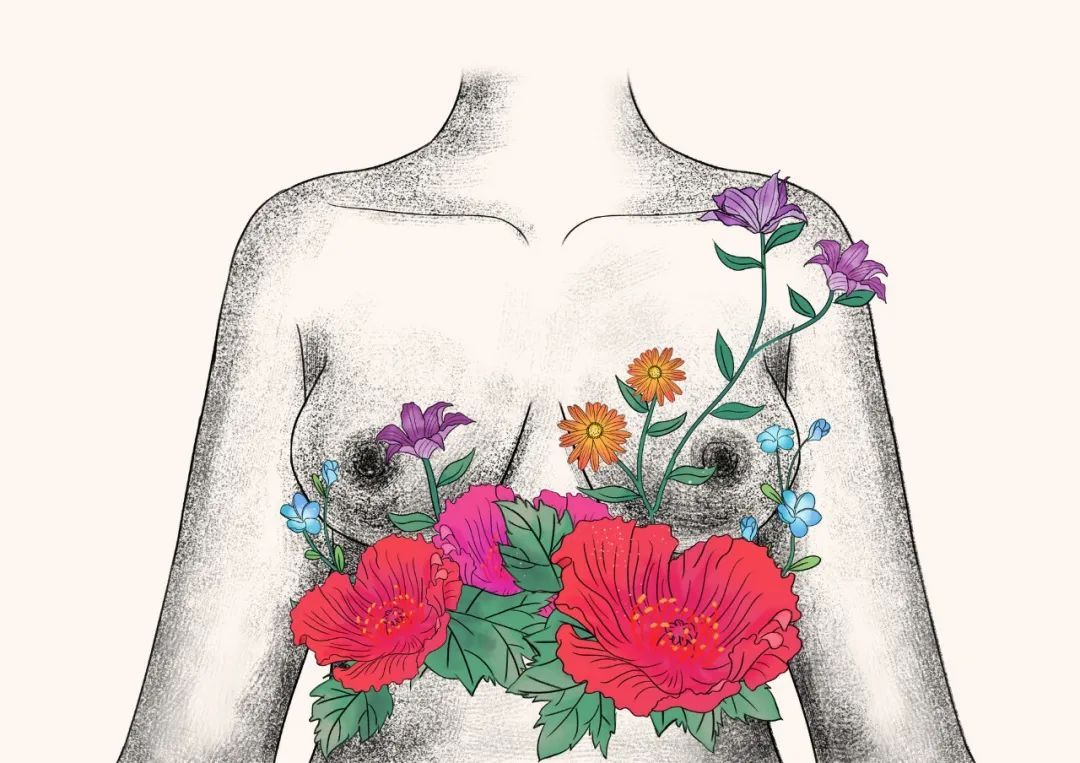 黄建|29岁患乳腺癌，这种手术方式居然找不到疤痕？健康美丽一步到位！