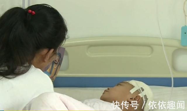 癫痫|4岁女童头上的胎记,一查竟是血管瘤,医生给出了答案