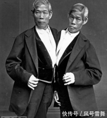 姑娘|连体哥哥爱上英国姑娘,弟弟每次只能回避,姑娘想一招三人都幸福