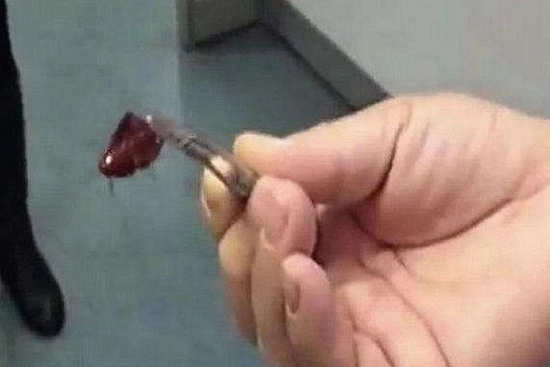 液体|娃耳朵进虫子,妈妈果断地处理方式救了孩子的听力,连医生都夸赞