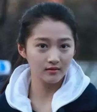 眼袋和黑眼圈是我们的颜值“天敌”！该如何应对？这3招或可参考