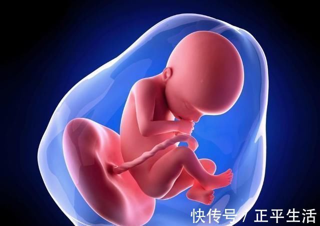 准妈妈|脐带绕颈是准妈妈“摸”出来的?别傻了,真正的原因只有这4个