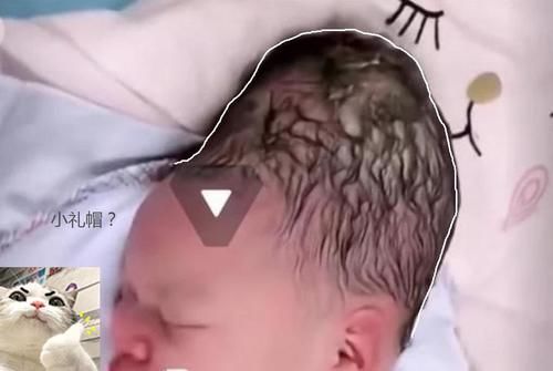 嫌弃|“黑脸宝宝”被亲妈嫌弃，护士却夸好看，2个月后高颜值逆袭