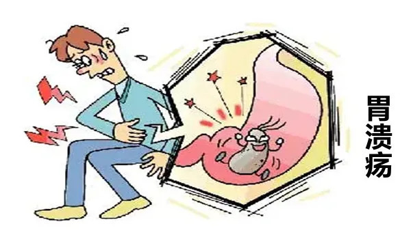 四联疗法双刃剑，不良反应是隐患|大白话说中医第一百六十期| 四联