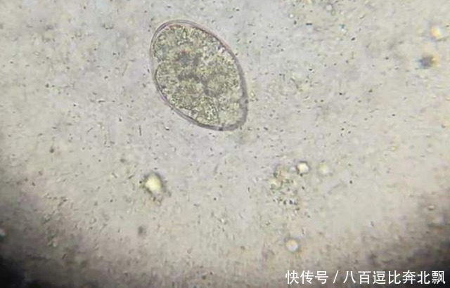 洗澡搓下的“黑泥”是什么？拿显微镜放大200倍，看完让人大开眼界