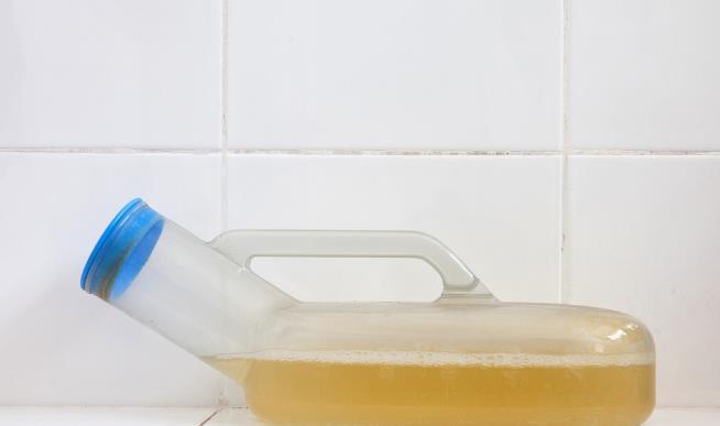 糖尿病患者要小心5个症状,提醒你糖尿病肾病来了,早发现早控制