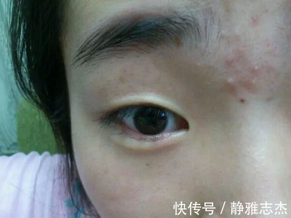 三七|70岁不长斑,她的诀窍竟如此简单,谁都可学会