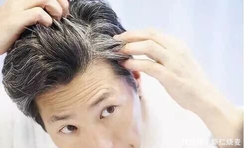 太阳穴|头发若有这四种表现,意味着你的肝脏可能在“中毒”,别不当回事