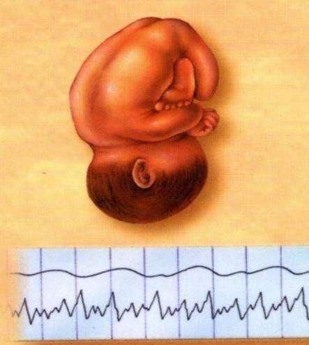 剖腹产|预产期过了4周,孕妇才去医院剖腹产,医生剖开后差点被熏晕