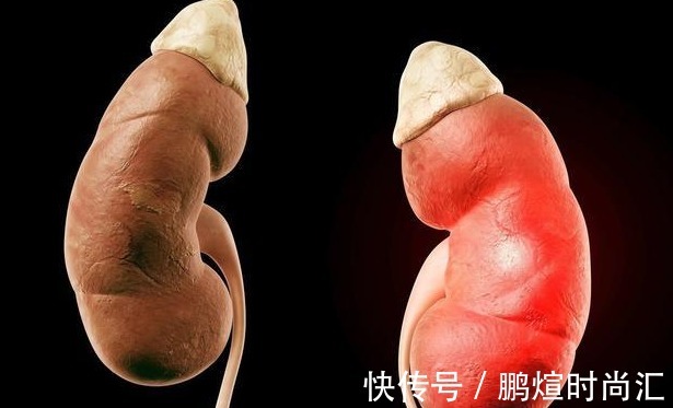 肾亏损|补肾“王牌”终于发现！不是猪腰子，没事常喝，肾越来越“强壮”