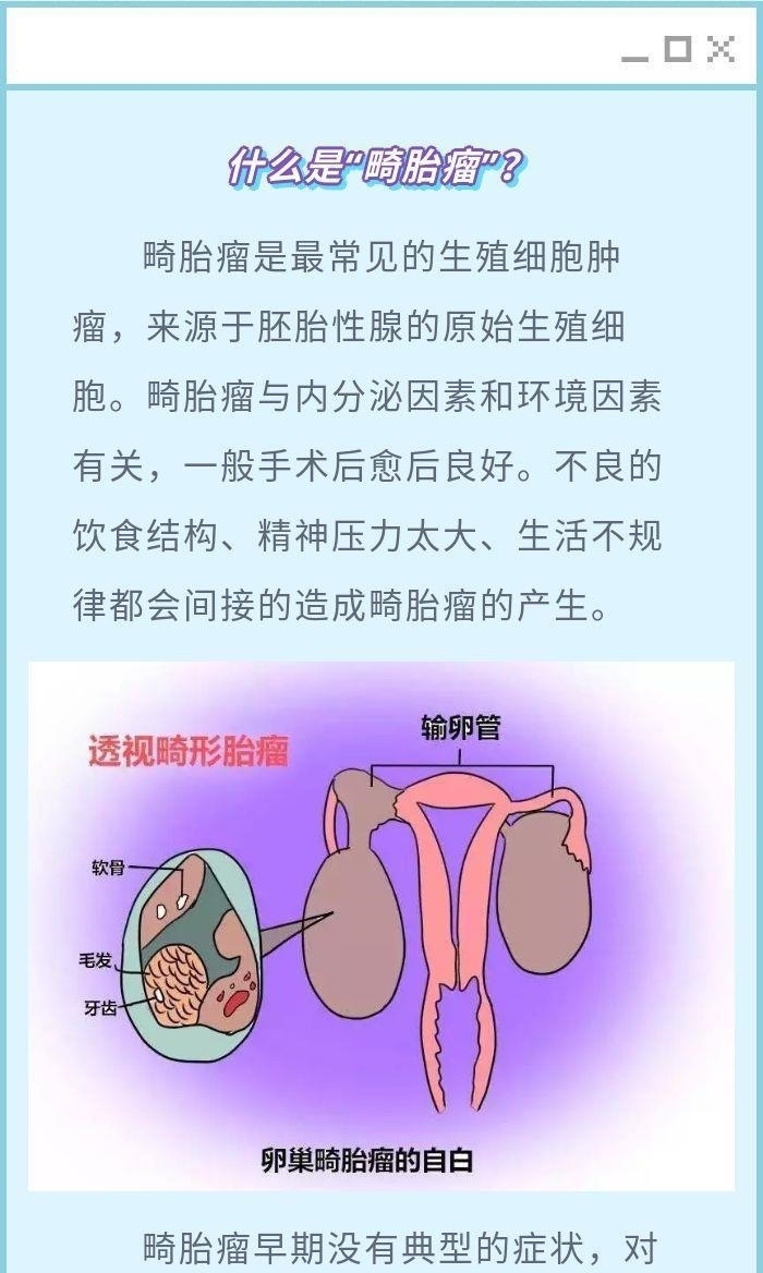 宫颈癌:警钟常鸣,预防为先