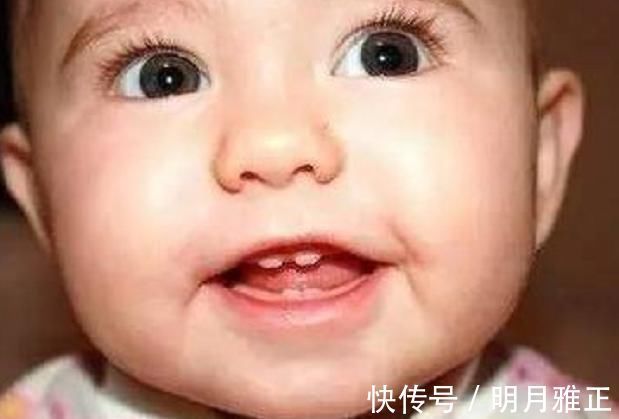 智齿|6岁男娃长“双层牙”,老人的“坏习惯”害了娃,你家有这习惯吗