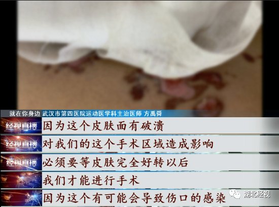 小郑|冰与干冰，一字之差！小伙选错致膝伤“雪上加霜”