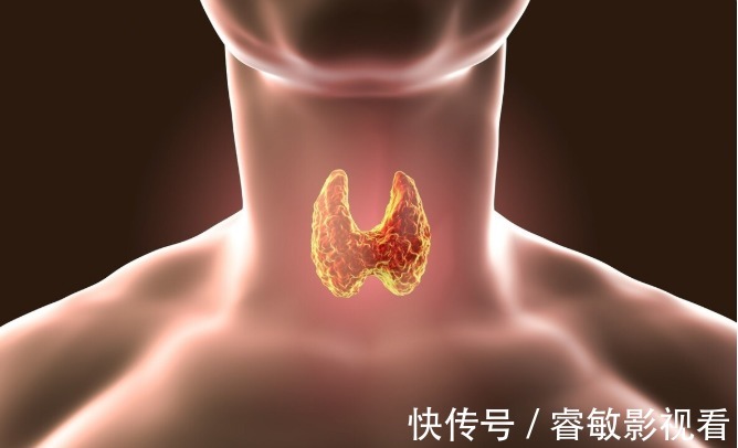 攻略|甲状腺结节的六大饮食禁忌，平时多注意，甲状腺会感谢你的