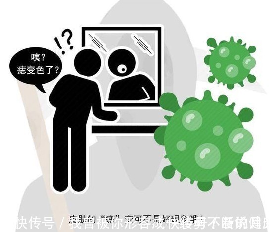 部位|哪种“痣”是危险分子?医生提醒:长在这3处的痣,要格外当心