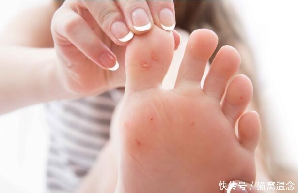 难以|糖尿病患者,血糖若难以控制,就会引发多种并发症,别忽视