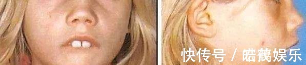 老公|3岁女儿越长越像猴子,老公怀疑老婆以前整容,查出原因家人凌乱!