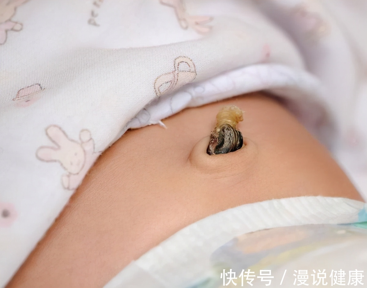 黑泥|肚脐眼里抠出臭臭的“黑泥”,到底是啥?真实答案有点重口味