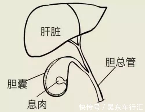 胃镜|长大后，它就成了癌！到底要多久？看完这篇，了解息肉的全部