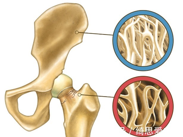 疼痛|为什么更年期的女性出现各种疼痛?该咋办?请看此文,医生告诉您