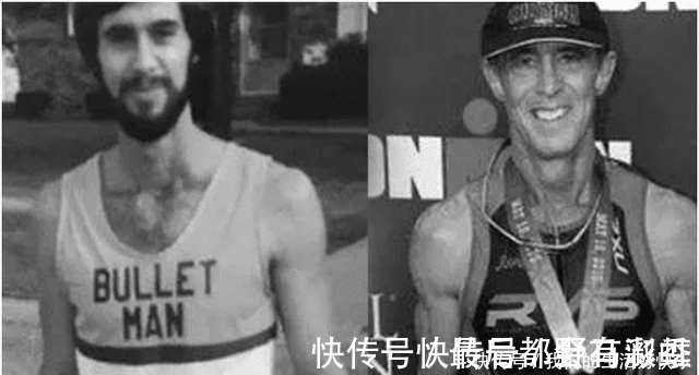 运动服|男子被子弹击中头部奇迹幸存,子弹卡在头骨上,却有了意外收获