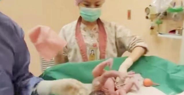 爸爸妈妈|宝宝出生后被带走十几分钟,这段时间经历了什么组图带你看真相!