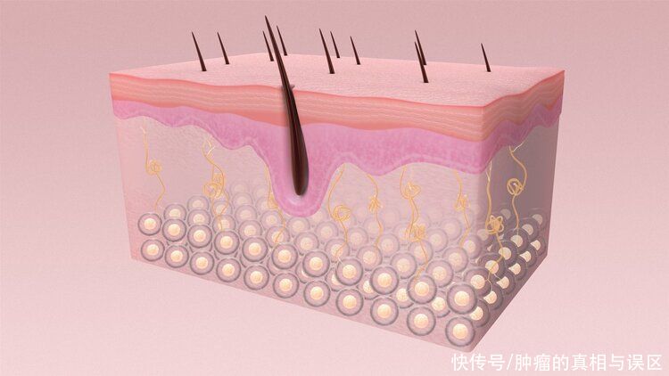 疤痕|一道疤20年長成癌？提醒：身上三種疤趕緊處理，或可癌變