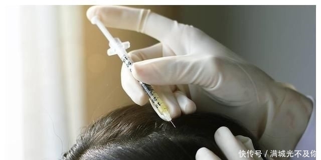 秃头女孩|晚上睡觉爱“散头发”多数女生搞错了,小心变成了“秃头女孩”