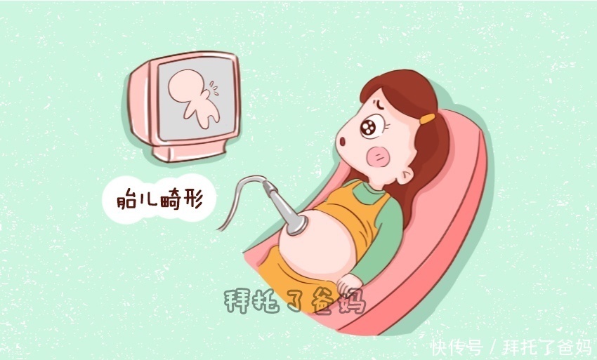 怀孕期间,这个时间段为胎儿畸形危险期,做好这3件事可合理规避