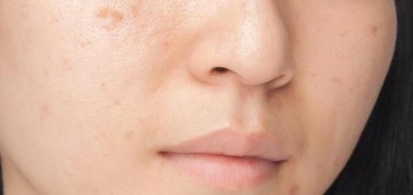 肝脏疾病|肝癌怎么越来越多,医生:有一种水果比喝酒更伤肝,不妨看一看