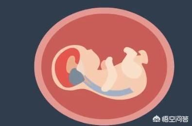 检查|为什么怀孕不到3个月,医生还让我做B超检查,有什么意义?