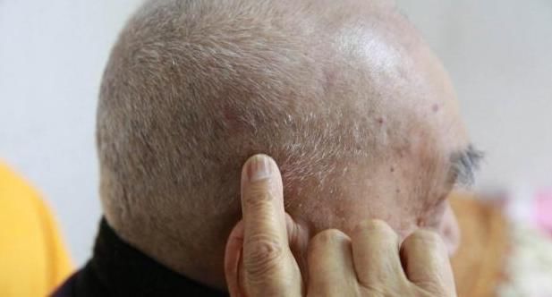 高盐食物|高血压患者,早晨醒来做好这3件事,让你的血压更加稳定