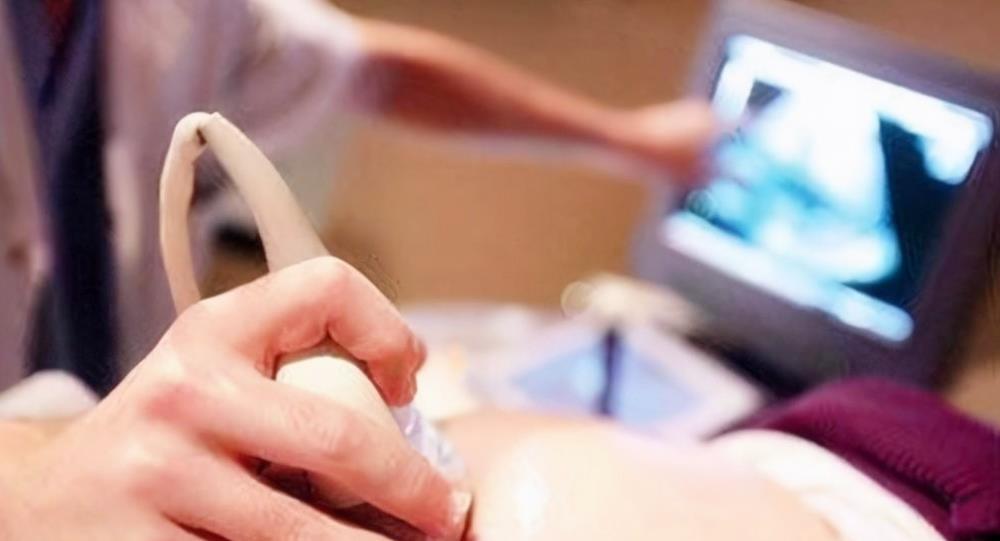 唐氏筛查|怀孕期间,产检时4种结果“异常”,可能是胎儿智力出现问题了