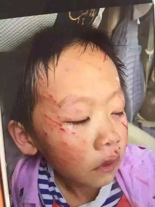 爸爸|“爸爸,我真的起不来了,拉我一下吧”,这是6岁女孩最后留下的话