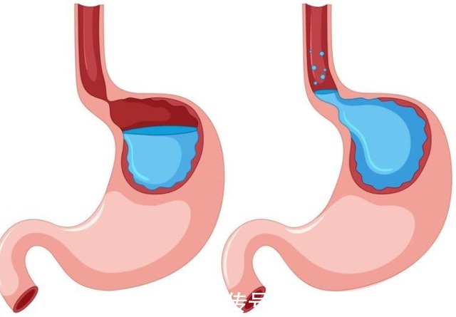 心慌|饿了就会心慌、手抖,这是怎么回事?
