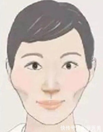 美力 颧骨高太阳凹陷自己怎么改善?科普3种医美方法,行之有效美力up!