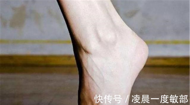 养生|48岁济南大姐,每晚坚持“踮脚”,一年后身体有什么变化