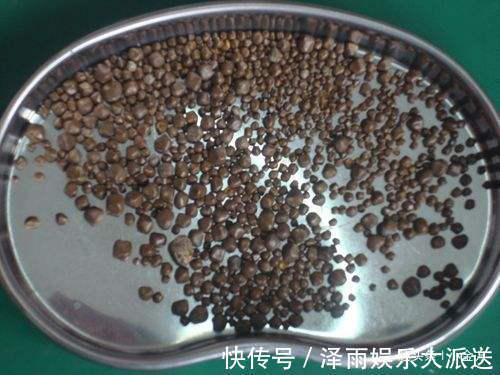 中医|中药材“郁金”打通血管里的瘀和堵,是金子总会发光!