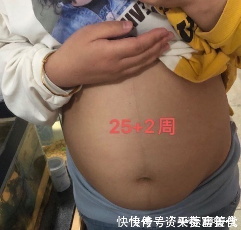准妈妈|通过了四维彩超,准妈妈却被甄别畸形,这是什么原因