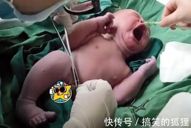 母乳|新生儿出生后,被护士抱走的10分钟经历了啥?这些处置一步不能少