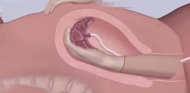 宝妈|顺产最痛的四个瞬间,过来人坦言第三个强忍,第四个彻底崩溃了