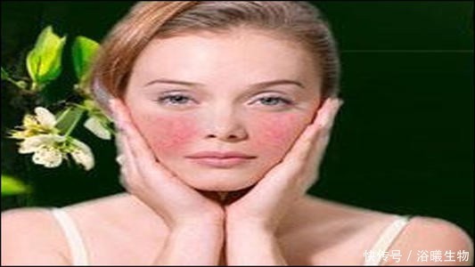 痘痘|长痘期间触碰这些禁忌,痘痘永远伴随你!