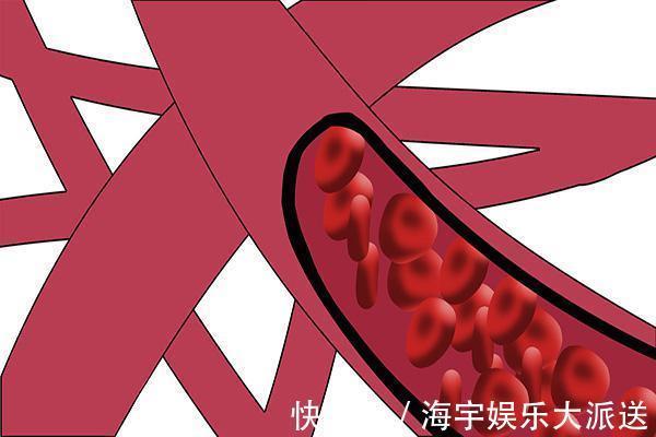 老年人|老年人定期输液,能冲走血管垃圾,预防中风有必要定期输液吗