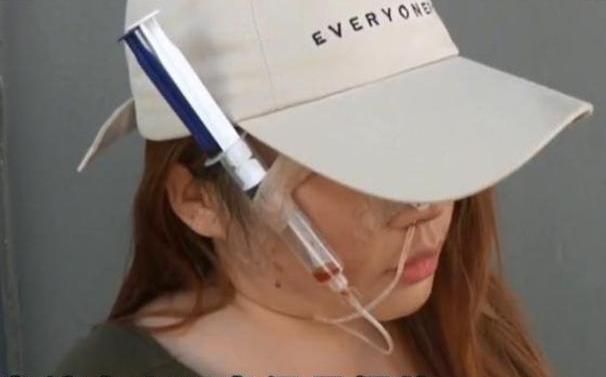 女子|妙龄女子花6万整容,如今脸上天天挂着注射器,医院:赔你13000元