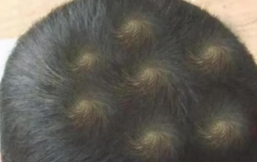 知晓|娃头上“一个旋”和“二个旋”有何区别?影响孩子性格,应知晓