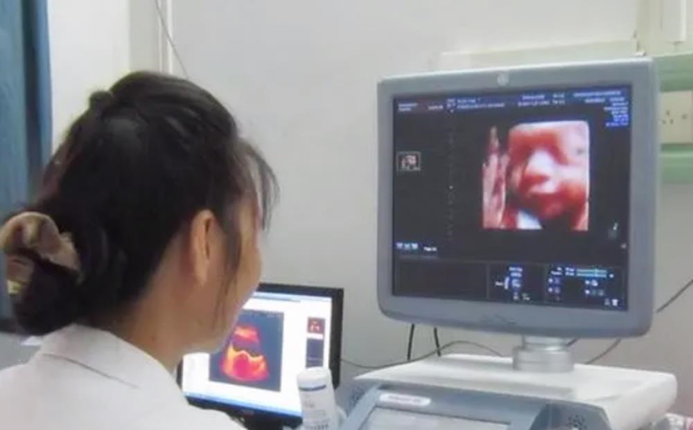 四维彩超|做四维彩超后,不做这步相当于“白花钱”,在检查前孕妈要问明白