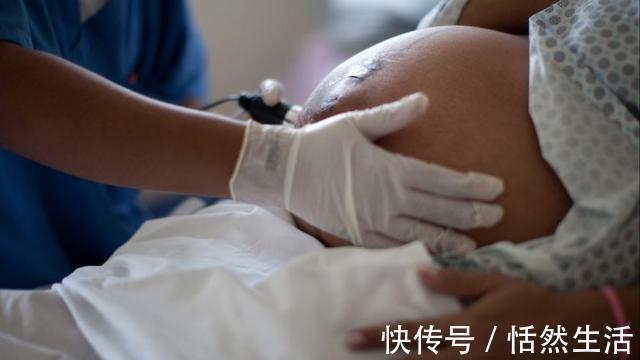 胎儿|孕期B超单上四个指标,暗示胎儿健康信号,达标孕妈可以放心了